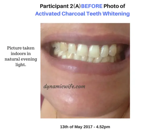 Activated Charcoal Teeth Whitening Experiment -2 REAL Before/After Pics