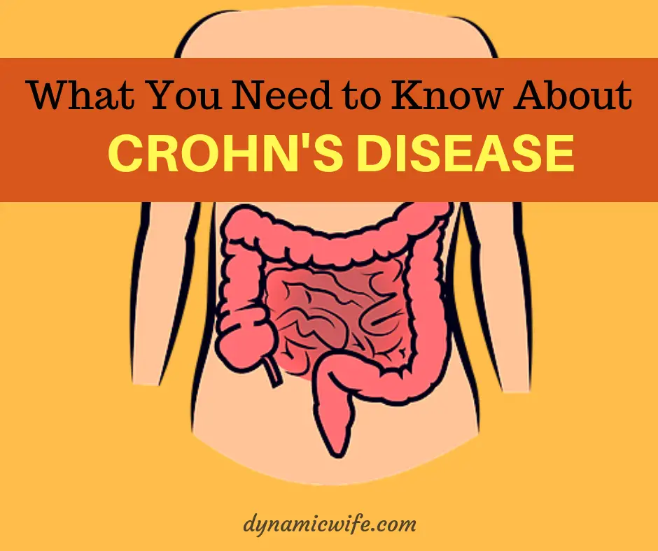 Crohns Disease Symptoms And Treatment Facts You Should Know 3265